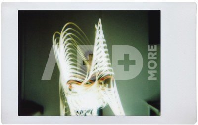 Lomo'Instant Automat Sundae Kids Edition Combo